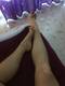 Legs